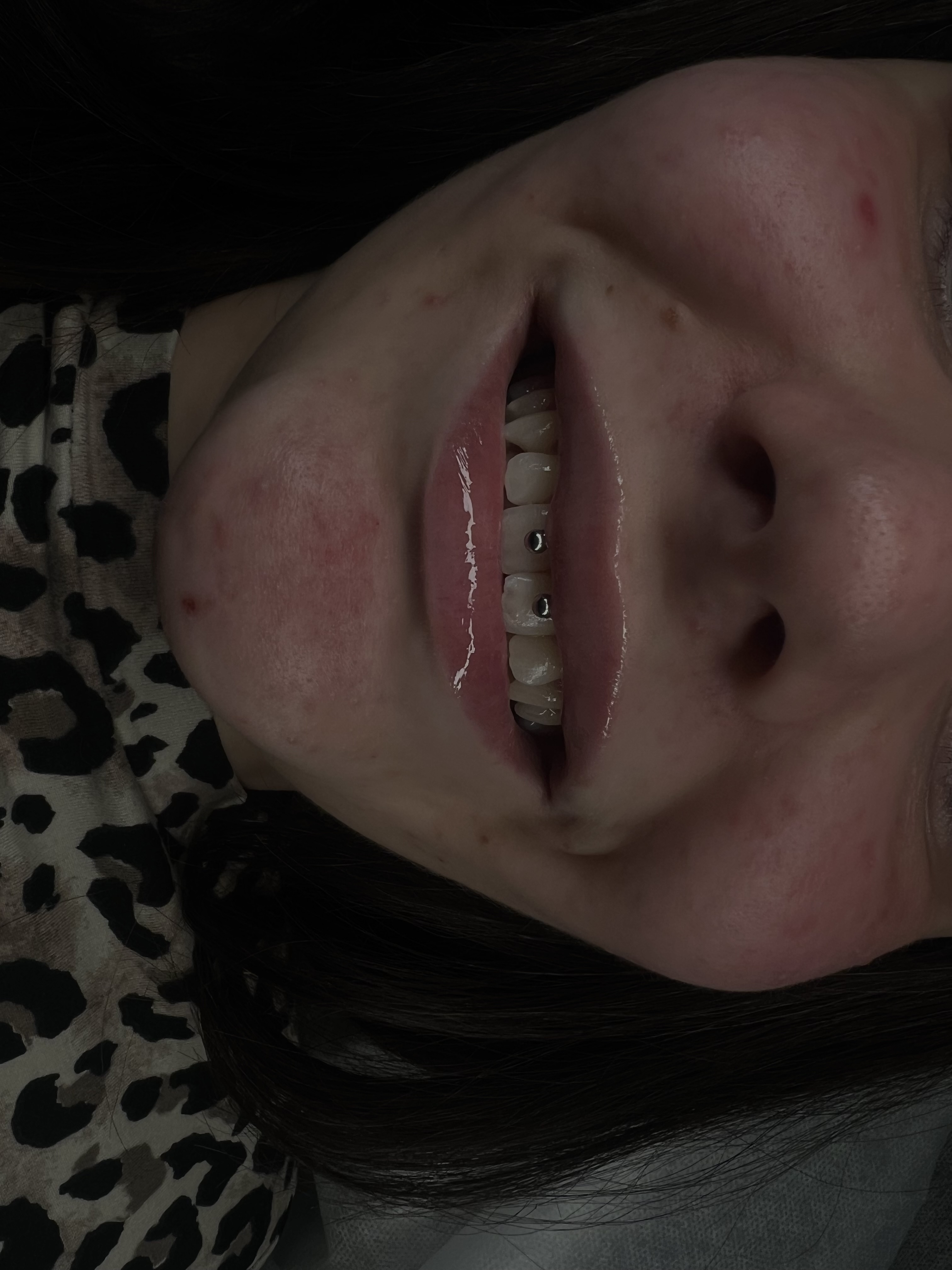 Piercing — resultat 6